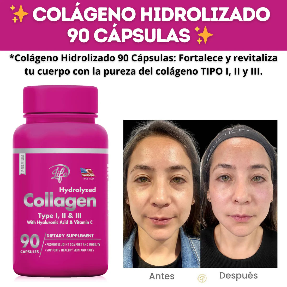 ✨ Colágeno Hidrolizado Tipo I, II y III con Ácido Hialurónico + Vitamina C